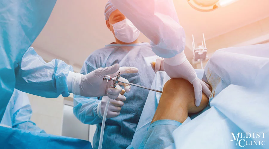 ARTHROSCOPIC SURGERY